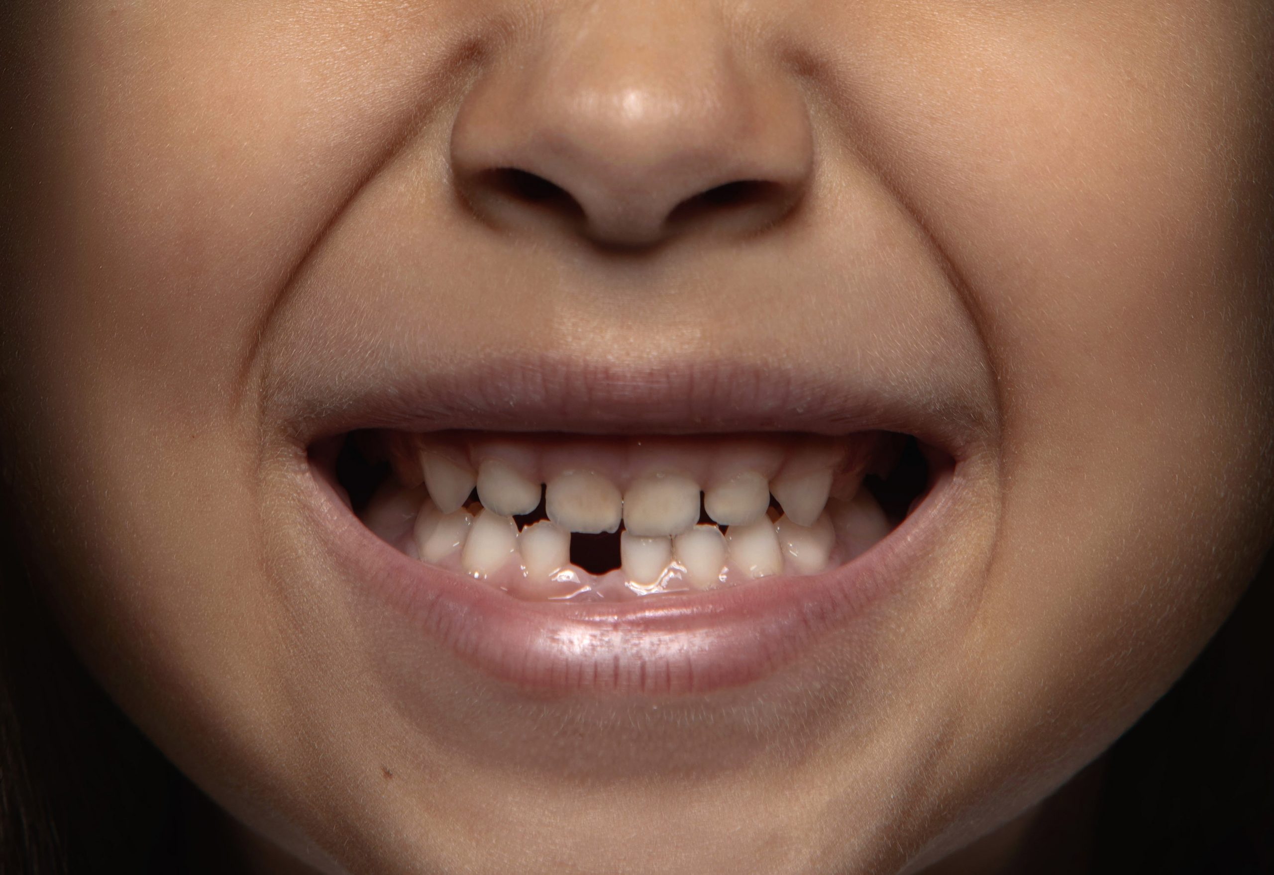 Das Gebiss des Menschen